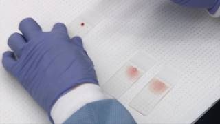 Making and staining blood smears [upl. by Ellehcar111]