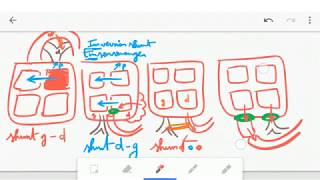 🔴 ASTUCE CARDIOPATHIES CONGENITALES   DR ASTUCE [upl. by Ebbarta55]