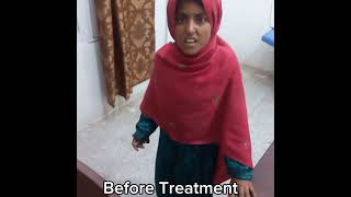 JUVENILE IDIOPATHIC ARTHRITIS JIA [upl. by Aicala]