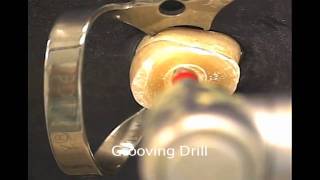 EZFit Fiber Post Placement with Grooving Drill [upl. by Whelan]