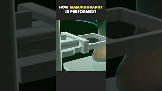 HOW MAMMOGRAPHY IS PERFORMED  3D ANIMATION [upl. by Aidnis]