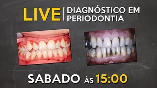 LIVE 045  Diagnóstico em Periodontia [upl. by Aihsi]