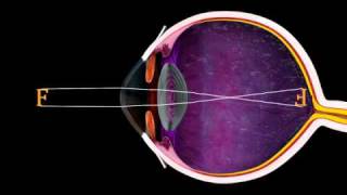 The Eye and Focus  3D Medical Animation  ABP © [upl. by Eissehc113]