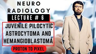 Difference between Juvenile Pilocytic Astrocytoma and Hemangioblastoma l Neuro Radiology l [upl. by Phyllida456]