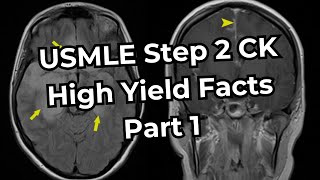 USMLE Step 2 CK High Yield Facts Part 1 [upl. by Della548]