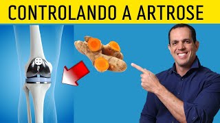 7 Dicas Para Quem Sofre com Artrose [upl. by Greenwald]