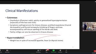 Management of hyperthyroidism Dr Sum setha [upl. by Mckinney]