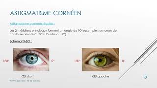 15 Cours Analyse de la Vision  Lastigmatisme de l’œil  BTS OL [upl. by Ettelrac]