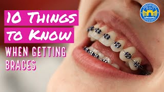 10 Things to Know When Getting Braces [upl. by Dnomsed]