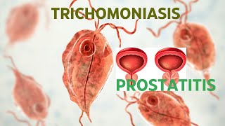 TRICHOMONIASIS ROLE IN PROSTATITIS [upl. by Eldoree]