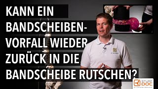 Kann ein Bandscheibenvorfall wieder zurück in die Bandscheibe rutschen  In drei Minuten erklärt [upl. by Eenot]