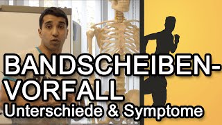 Bandscheibenvorfall  Unterschiede amp Symptome [upl. by Sitoeht898]