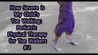 2 How Severe is My Childs Toe Walking Pediatric Physical Therapy for Toe Walkers [upl. by Suirtimed]