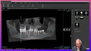 Dental Treatment Planning in a Medically Compromised Case [upl. by Nessy]