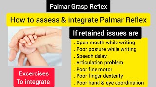 Palmar grasp reflexsolve writing amp speech issueshow to assess amp integrate palmar reflex [upl. by Anialad]