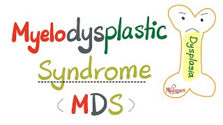 Myelodysplastic Syndrome MDS  a precursor to Acute Myeloid Leukemia AML   Hematology Series [upl. by Aisela]