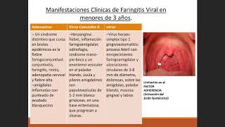 Pediatría  Faringoamigdalitis Aguda y Laringotraqueitis 11 [upl. by Koser828]