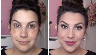 FULL COVERAGE Makeup for Melasma amp Discoloration [upl. by Quint]