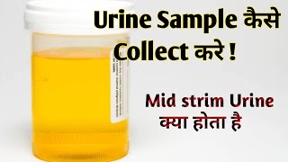 mid stream urine collection procedure II urine specimen collection procedure [upl. by Trust975]