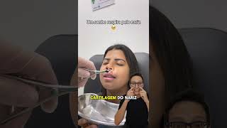 Desvio de Septo Nasal 😱medicina medico otorrinolaringologia cirurgiaplastica splinter nariz [upl. by Anileuqcaj]