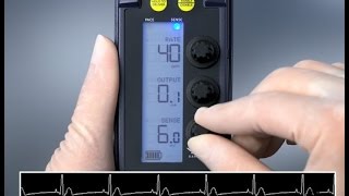 Sensing and Threshold Test — 53401 Temporary Pacemaker [upl. by Anuat664]