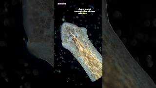 Freshwater Flatworm Under Microscope Planarian [upl. by Thirzi]