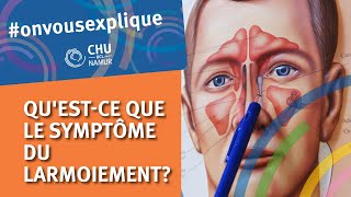 On vous explique  le symptôme du Larmoiement [upl. by Ful227]