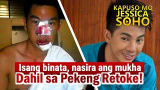 Kapuso Mo Jessica Soho July 7 2024  BINATA NASIRA ANG MUKHA DAHIL SA RETOKE  KMJS PARODY [upl. by Floss342]