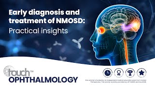 Early diagnosis and treatment of NMOSD Practical insights [upl. by Anjela512]