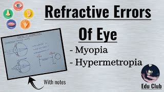 Refractory Errors Of Eye  Myopia  Hypermetropia  Special Senses Physiology [upl. by Evangelin]