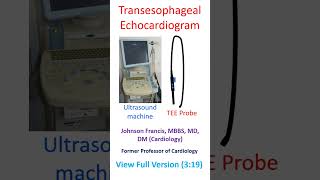 Transesophageal echocardiogram [upl. by Avert917]