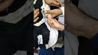 Cannula procedure easy pass youtubeyoutuberloveyoutubeshortsytshortsyoutubevideoyoutubevideos [upl. by Yhtac]