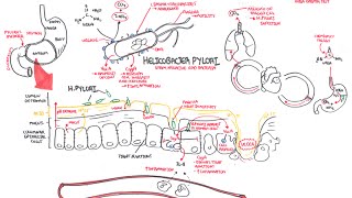 Microbiology  Helicobacter Pylori Ulcer [upl. by Eradis458]