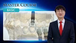 Master Course  BASIC ABT Level vs Implant Level Impression PART 2 [upl. by Eiramave317]