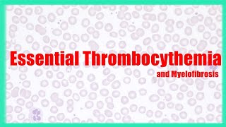 Essential Thrombocythemia and Myelofibrosis  WBC disorders  Usmle Hematology speedymedicalusmle [upl. by Jain754]