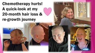 Chemotherapy hair effects A quicklook at my 20month hair loss and regrowth journey [upl. by Nonnahsed]