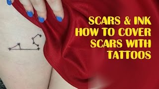 Scars amp Ink ►How to Cover Scars with Tattoos [upl. by Ordnas]