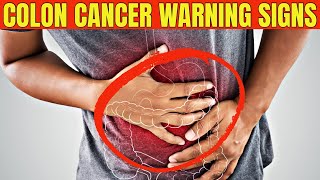 What Are The Signs And Symptoms Of Colon Cancer [upl. by Saihtam]